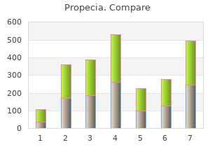 cheap propecia 5mg without a prescription