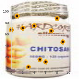 Hepatic veno-occlusive disease