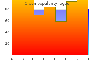 order creon 150 mg overnight delivery