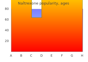 order 50mg naltrexone fast delivery