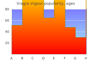 buy generic viagra vigour 800 mg line