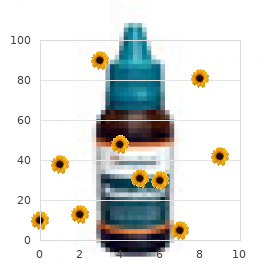 Trigonomacrocephaly tibial defect polydactyly