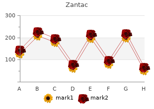 buy zantac 150mg otc