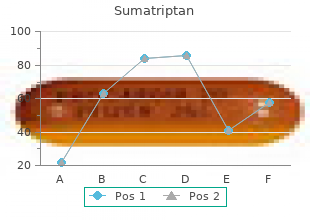 buy cheap sumatriptan 50mg online