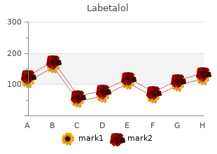 order 100 mg labetalol free shipping